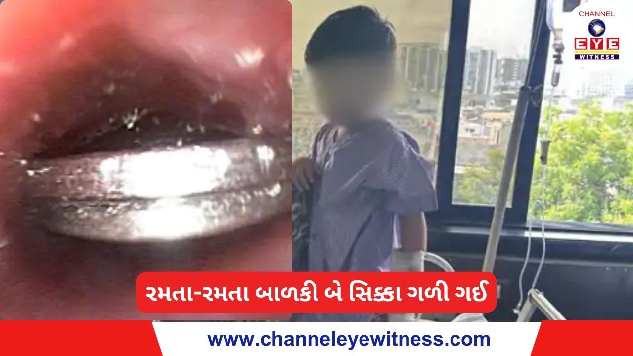 રમતા-રમતા બાળકી બે સિક્કા ગળી ગઈ